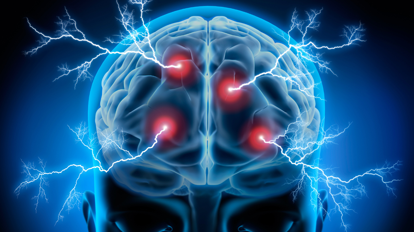 EEG Testing, QEEG Testing, routine eeg