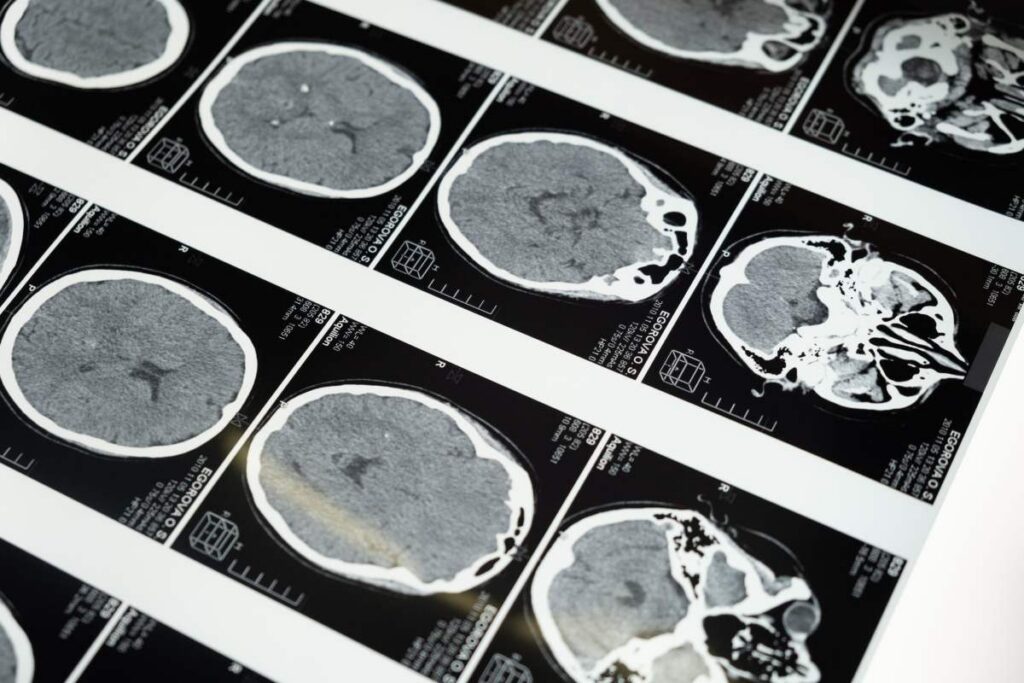 Why standard imaging falls short