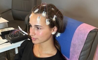 QEEG Brain Map Interpretation